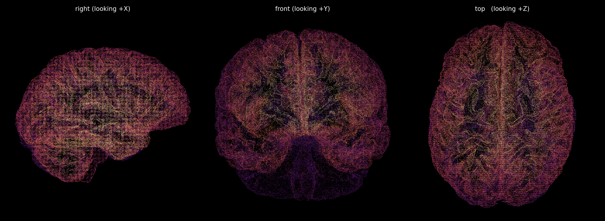 3-view render of a verified brain's brain